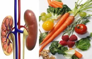 What is the Diet for kidney Disease?