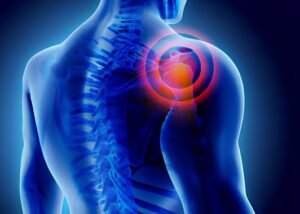 FROZEN SHOULDER