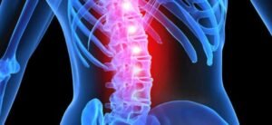 SPINAL CORD INJURY