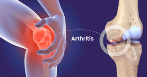 Locomotor Disability- what are the types,symptoms,and causes?Aaziban