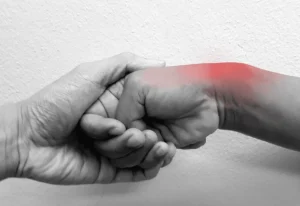 De Quervain’s Tenosynovitis