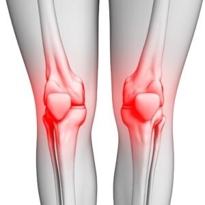 Osgood-Sehlatter’s Syndrome