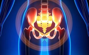 Pelvic Floor Dysfunction