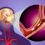 Transient Ischemic Attack