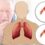 Chronic Obstructive Pulmonary Disease(COPD)