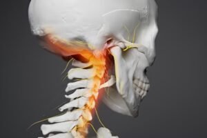 Vertebro Basilar insufficiency