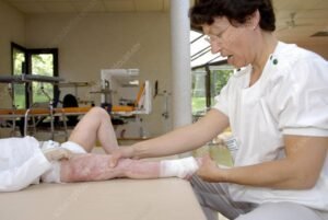 Post Burn Rehabilitation