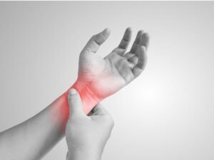 Carpel Tunnel Syndrome