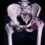 TUBERCULOSIS OF THE HIP JOINT
