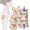 Compression Fractures