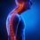 Kyphosis