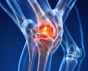 Osteogenesis Imperfecta: Challenges in Treatment and Physiotherapy