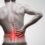 Cauda Equina Syndrome