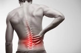 Cauda Equina Syndrome