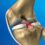 Posterior  Cruciate Ligament Injuries