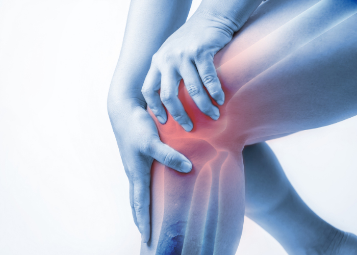 Chondromalacia Patellae