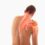 Subacromial Bursitis: A Comprehensive Guide to Shoulder Pain Relief