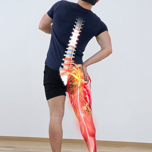Sciatica