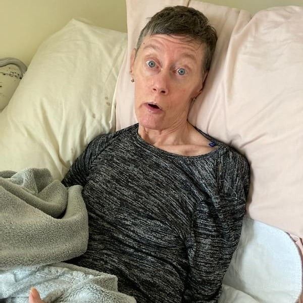 Huntington’s Disease