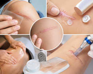 Effective Scar Management: From Healing to Functional Recovery