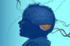 Anterior Cord Syndrome