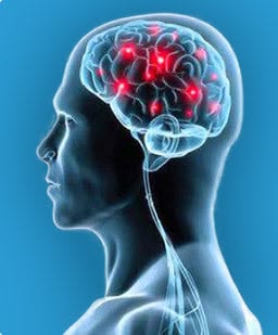 Bacterial Meningitis