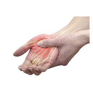 Median Nerve Injury: Clinical Features and Rehabilitation Approach