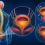 Neurogenic Bladder: Causes, Symptoms & Physiotherapy Management