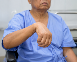 Flexion Synergy: Breaking Abnormal Patterns Through Therapy