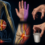Ulnar Nerve Injury: Clinical Features and Physiotherapy Management