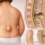 A Complete Guide to Meningocele Care and Rehabilitation