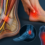 Tarsal Tunnel Syndrome: Causes, Symptoms, and Physiotherapy Management
