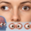 Ectoprism: A Clinical Insight into Ocular Alignment Disorders