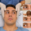 Doll’s Eye Reflex: Understanding Its Clinical Importance and Physiotherapy Considerations