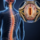 Hydromyelia: Causes, Symptoms, Physiotherapy Management, and Complications